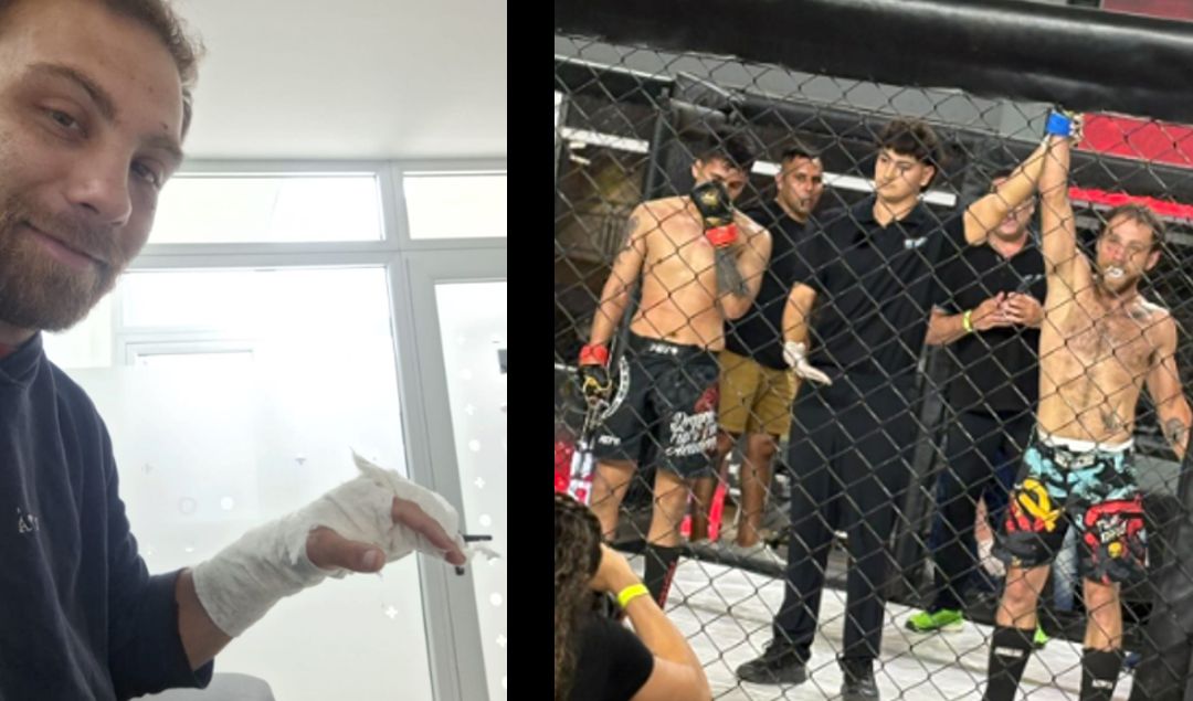 Con el corazón de un verdadero guerrero, el nicoleño Franco “Lobo” Tombolesi protagonizó una de las actuaciones más impactantes de su carrera. En su último combate de MMA disputado en la localidad de Zárate, logró la victoria pese a haber peleado con una fractura en su mano derecha, una lesión que sufrió en pleno primer round y que no le impidió seguir hasta el final.